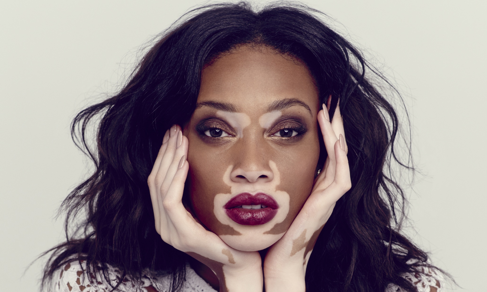 1. Winnie Harlow (born Chantelle Brown-Young)