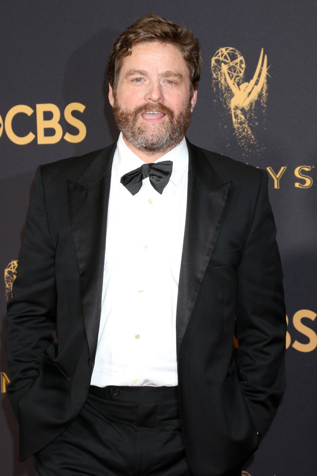 zach galifianakis celebrity weight loss stories