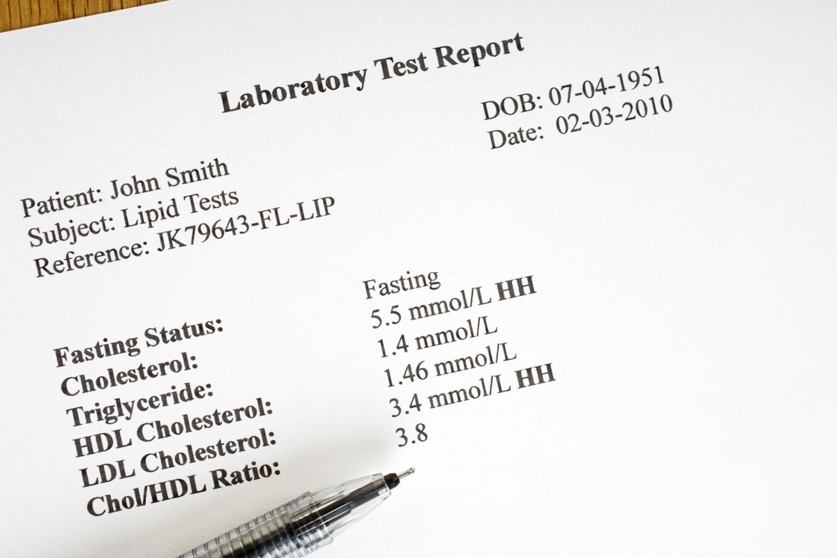 cholesterol test