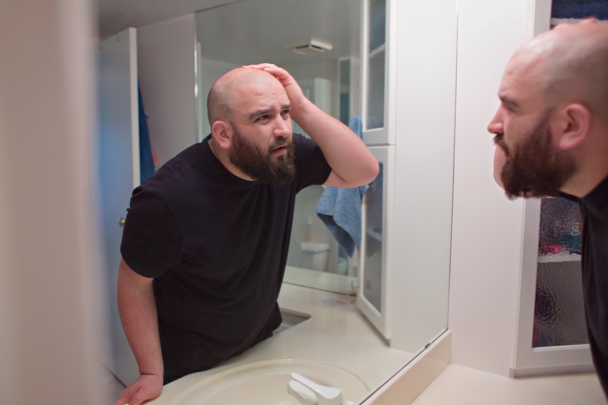 an unhappy man looking in the mirror touching the missing hair on top of his head