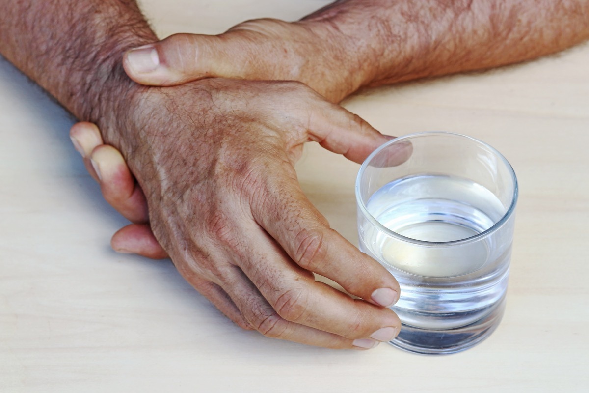 parkinsons disease hands