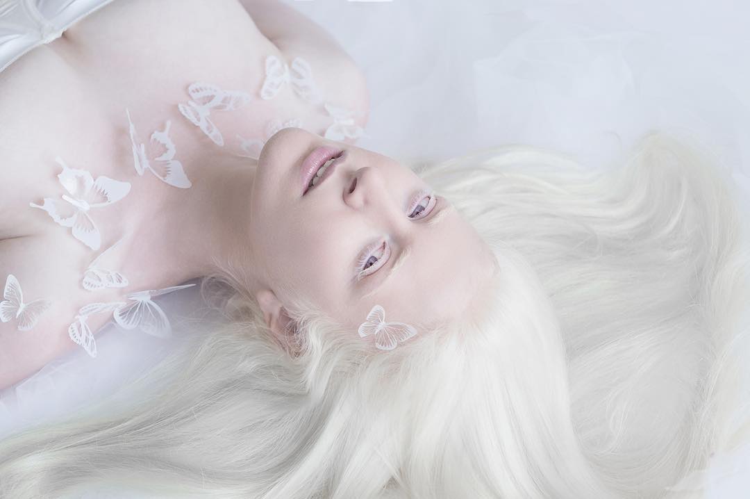 breathtaking-beauty-of-albinos-was-captured-by-a-photographer-05