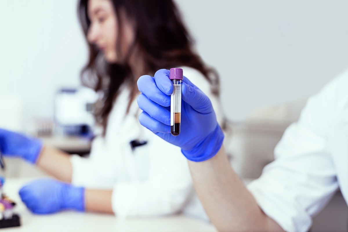 Hand of a lab technician holding blood tube test. Health care researchers working in life science laboratory. Doctor holds a blood sample tube in his hand testing in the laboratory