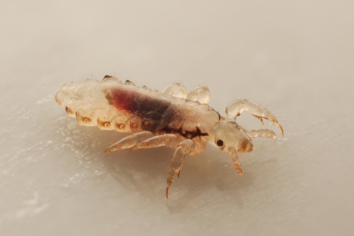 head lice dangerous bugs in america